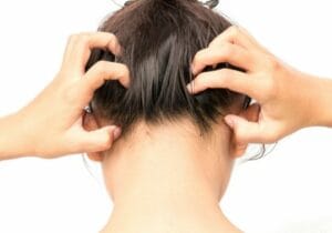 Сърбеж в скалпа